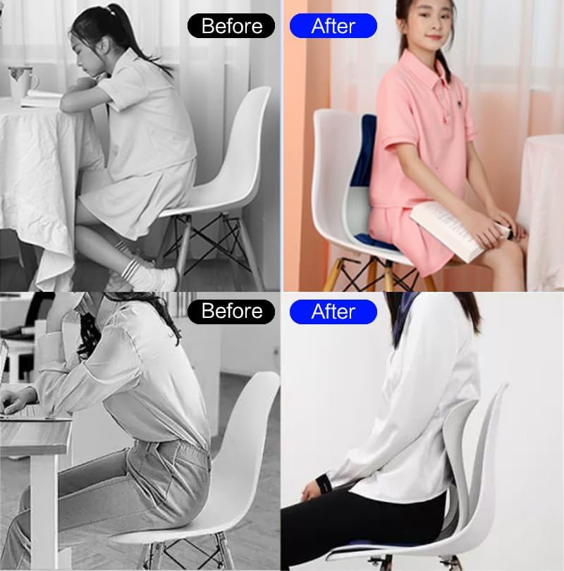 SpineAlign Back Support